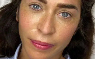 Tratamientos faciales. Alternativas no invasivas para transformar tu look